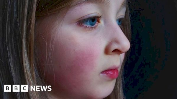 ‘daughter’s-long-covid-makes-us-prisoners-in-our-own-home’-–-bbc