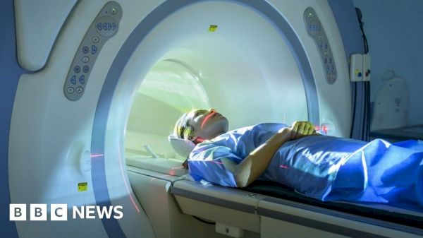 elgin-scanner-could-help-ease-pressure-on-mri-services-–-bbc