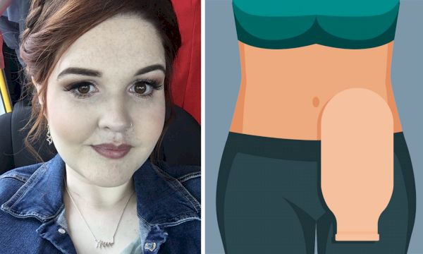 shetland-woman-sets-up-local-stoma-support-group-–-the-press-&-journal