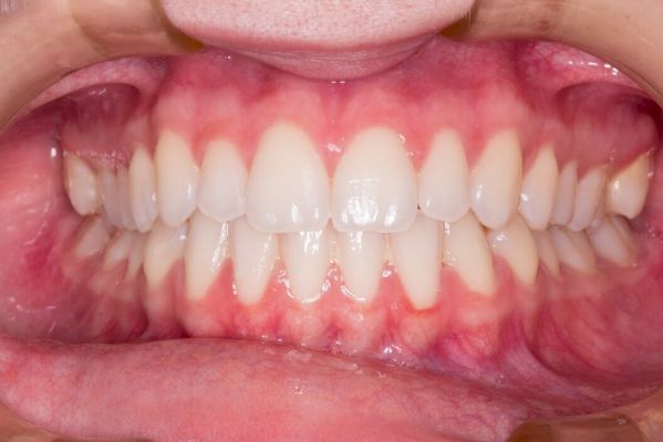 free-screening-clinics-offered-amid-big-increase-in-mouth-cancer